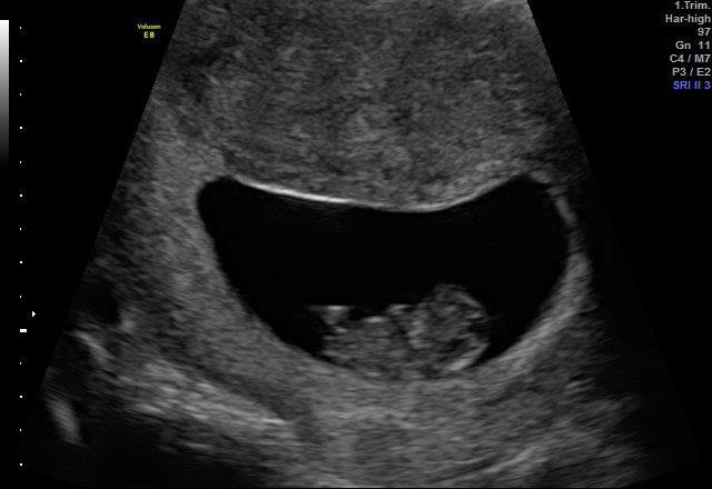 10-WEEKS