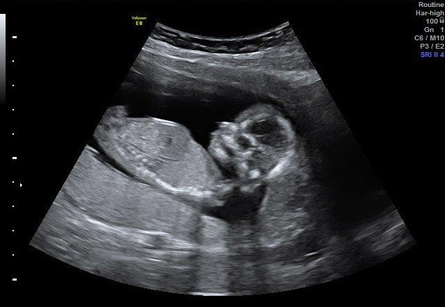 15-WEEKS 2