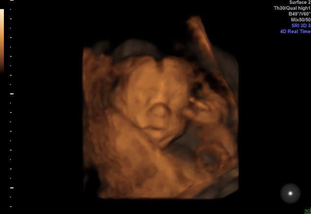 19-WEEKS 3