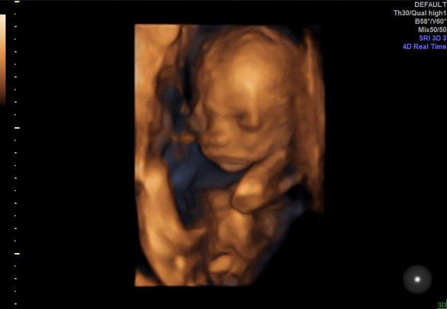 20-WEEKS 3