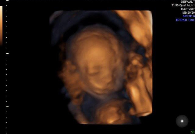 21-WEEKS 2