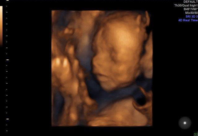 22-WEEKS 2