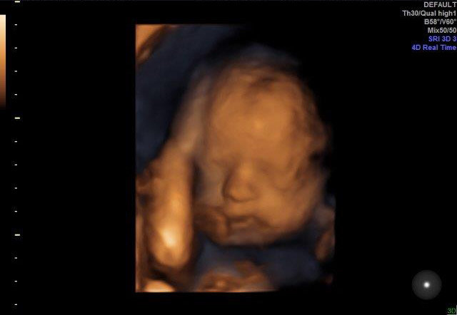 25-WEEKS 3