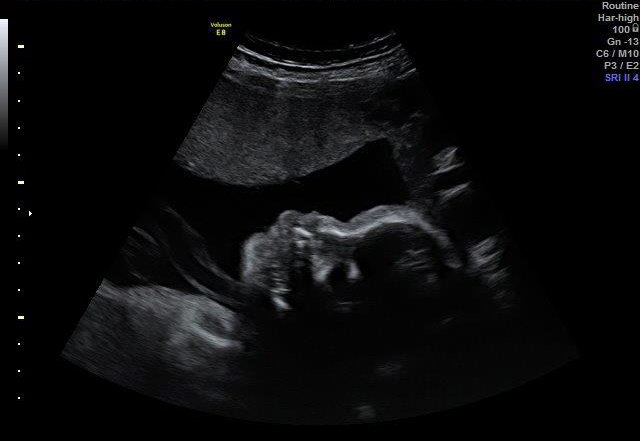 27-WEEKS 3