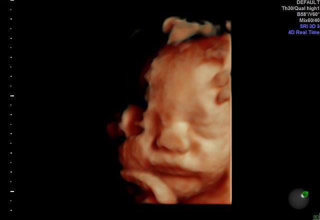 28-WEEKS 3