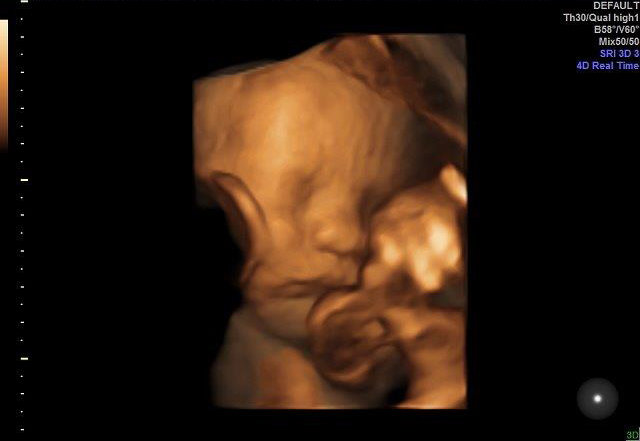 28-WEEKS 4