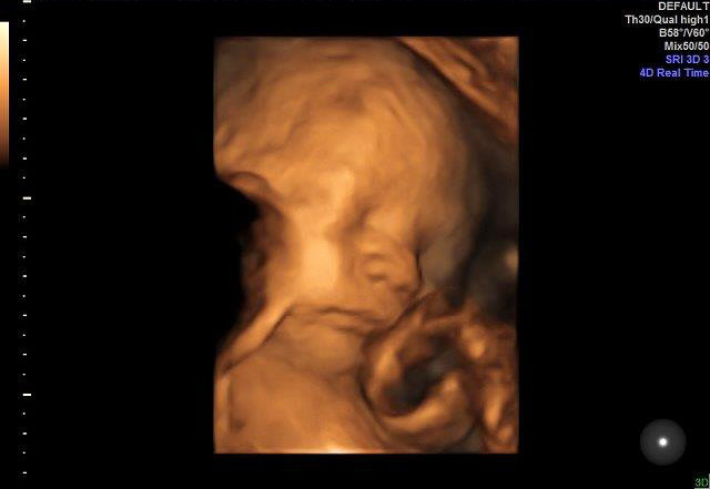 28-WEEKS 5