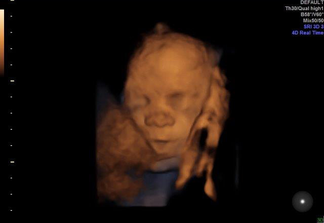 29-WEEKS 2