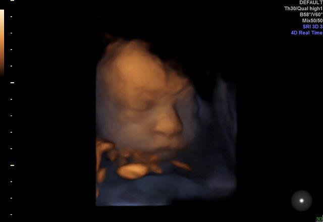 29-+-2-WEEKS 1