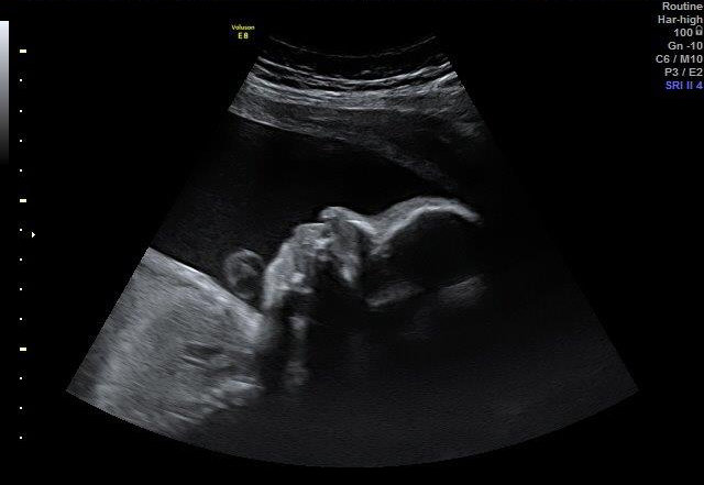 29-+-2-WEEKS 3