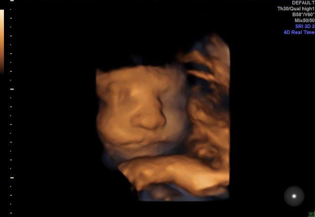 30-WEEKS