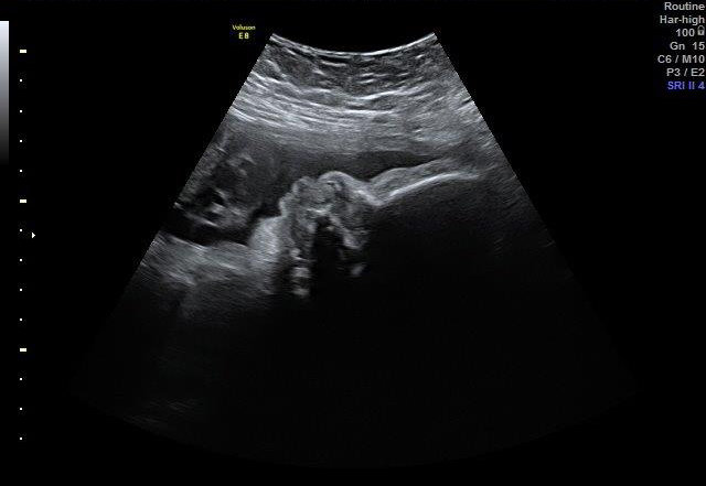 32-WEEKS 1