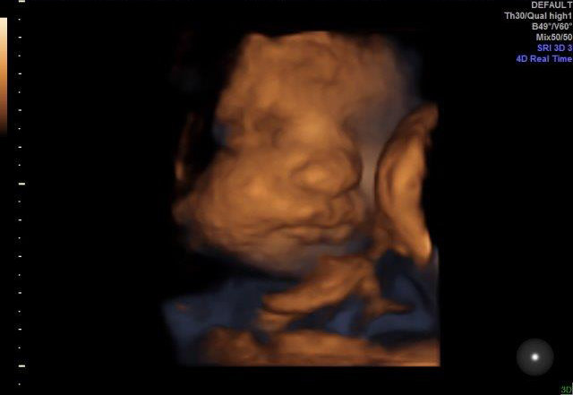 32-WEEKS 2