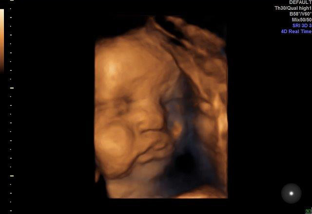 33-WEEKS 1