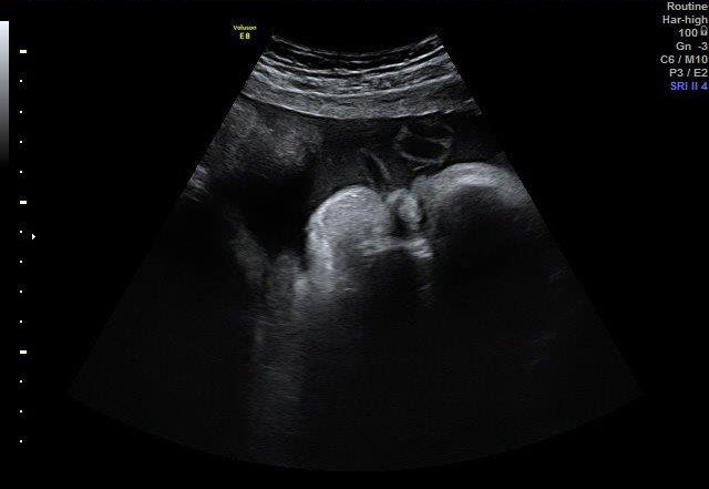 33-WEEKS 2