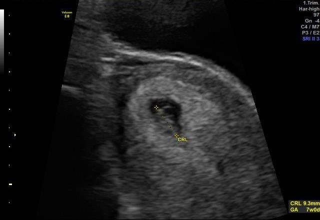 7-WEEKS