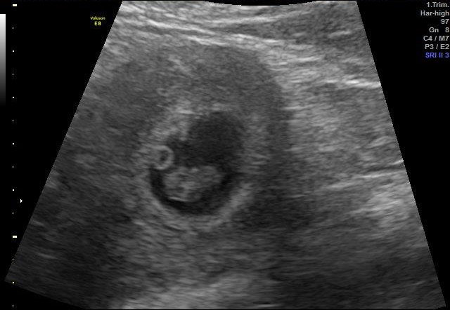 8-WEEKS