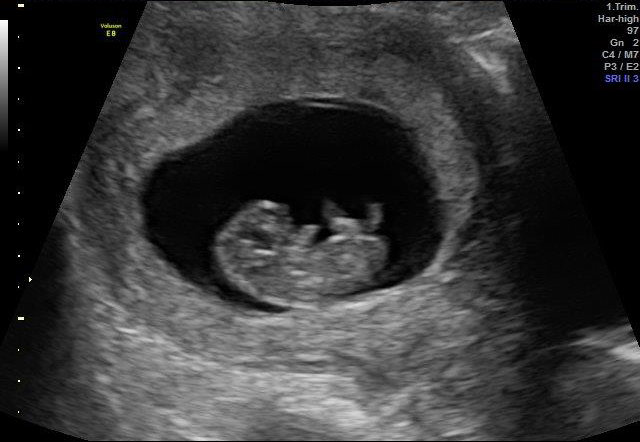 9-WEEKS