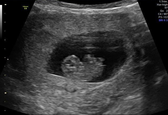 9-WEEKS 2