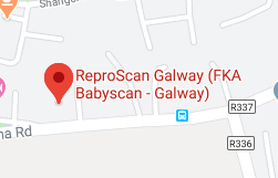 Galway